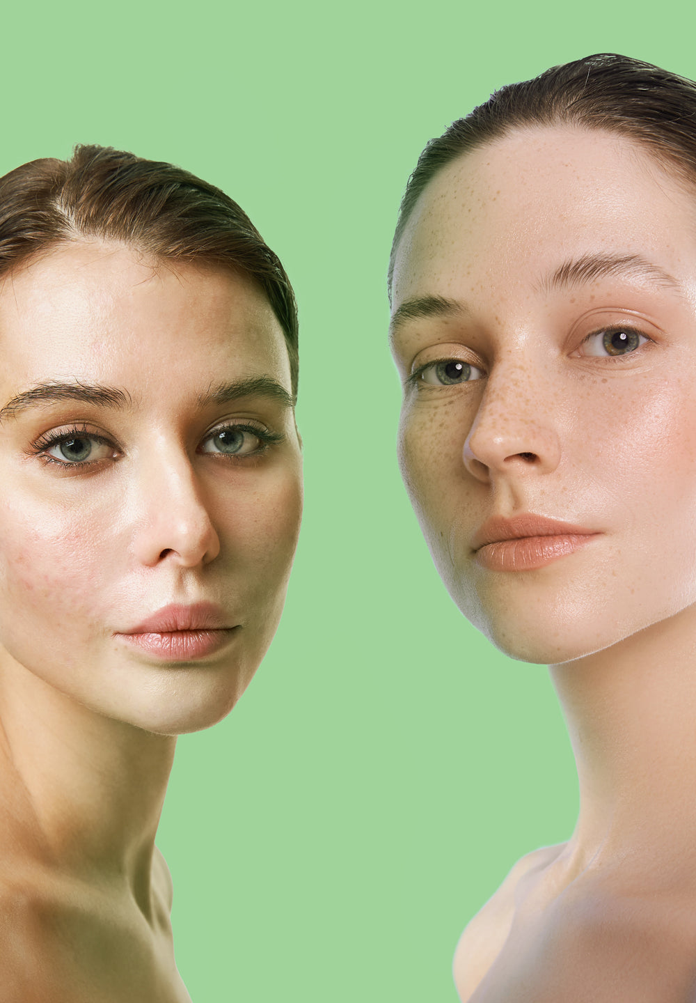 ACTI-CLEAR Global AC Anti-Imperfection Gel Cream 50ml