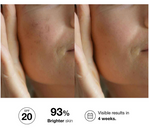 Bella Aurora Bio10 Forte Serum SPF20 Normal-Dry 30ml – product photo