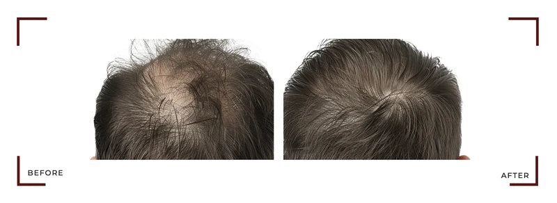 Capixy Anti-Hair Loss Vials 70ml – product photo