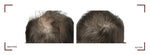 Capixy Anti-Hair Loss Vials 70ml – product photo