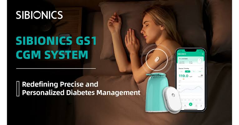 SIBIONICS GS1 CGM Sensor (1 Sensor/14 Days) – product photo
