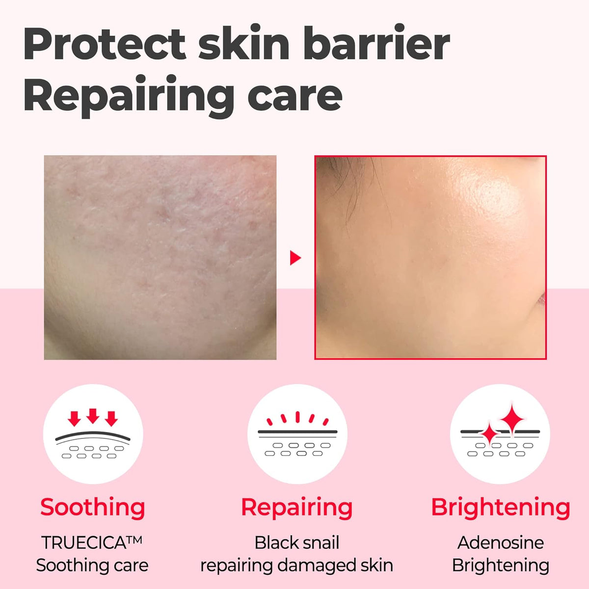 SOME BY MI Snail Truecica Miracle Repair Serum 50ml | Calming Skin Barrier Care – product photo