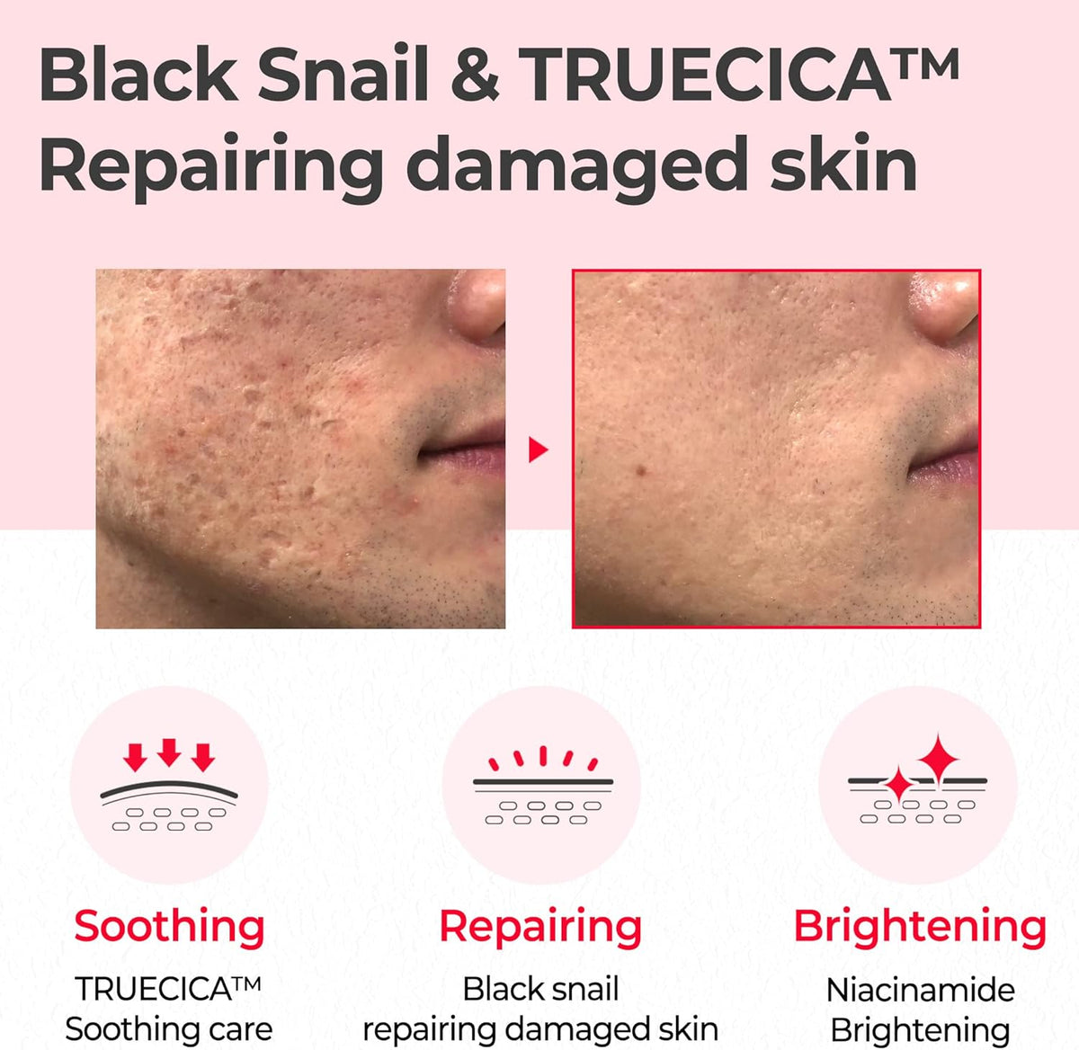 SOME BY MI Snail Truecica Miracle Repair Toner 135ml | Repairing Hydration Toner – product photo