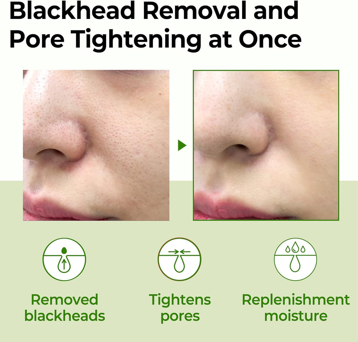 SOME BY MI Super Matcha Pore Tightening Toner 150ml | Refined Pores, Fresh Skin – product photo